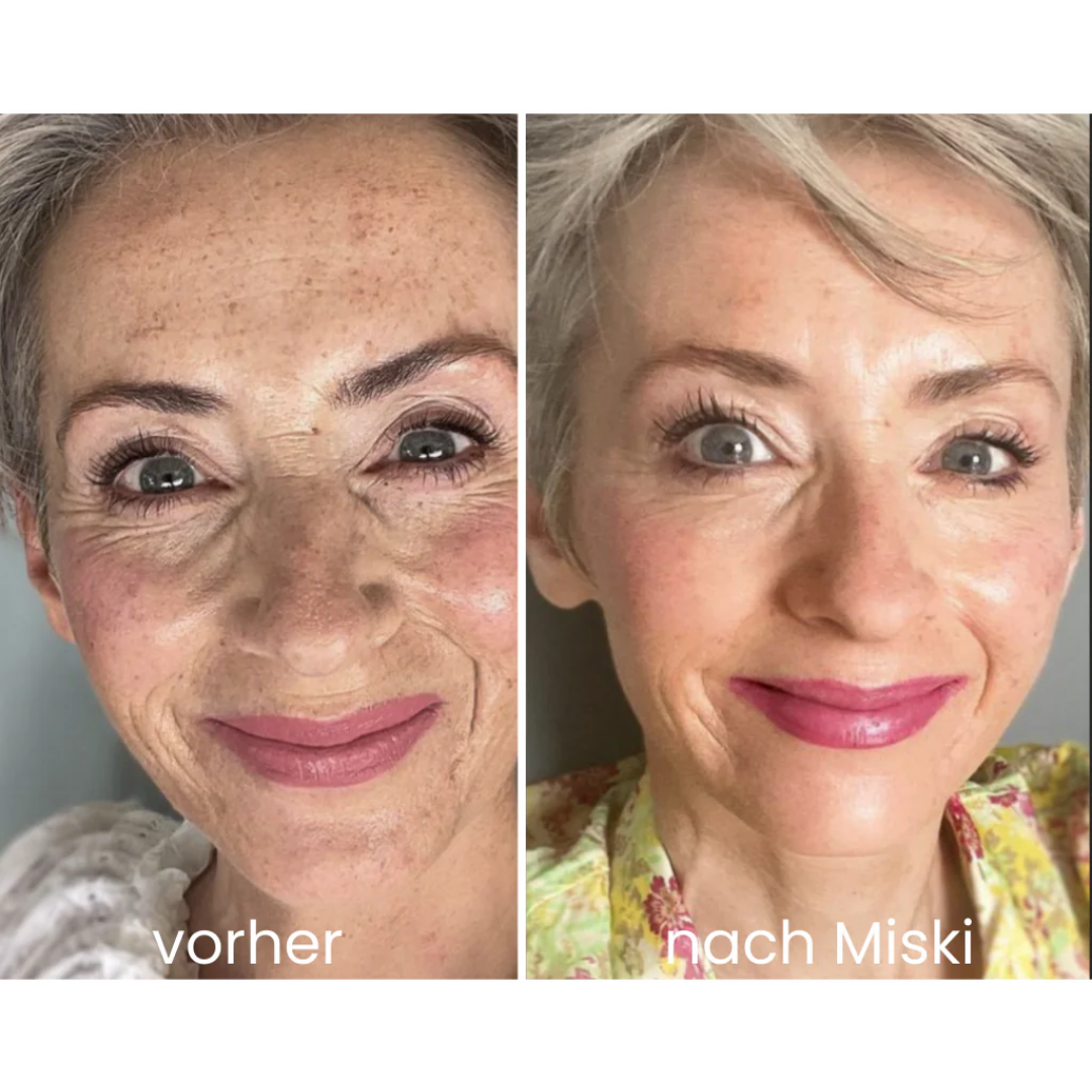 Miski Micro-Infusion-System