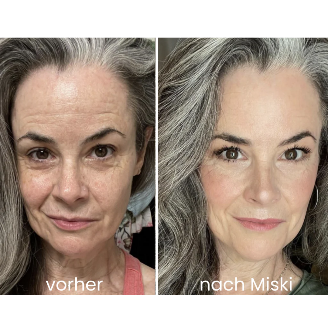 Miski Micro-Infusion-System