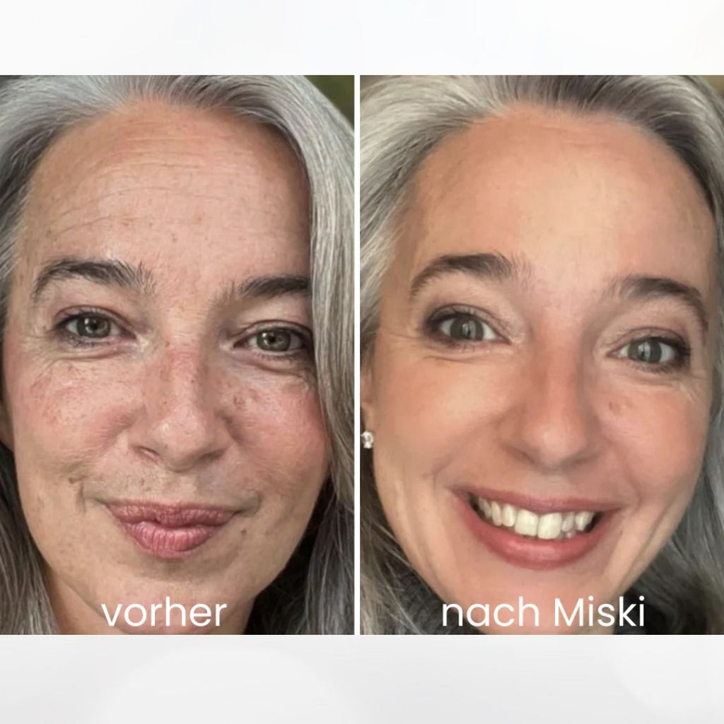 Mikro-Infusionssystem